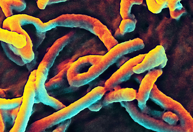 Ebola