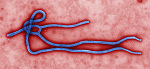 This colorized transmission electron micrograph (TEM) revealed some of the ultrastructural morphology displayed by an Ebola virus virion. See PHIL 1832 for a black and white version of this image.