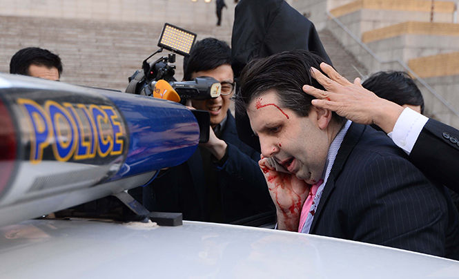 Injured U.S. Ambassador to South Korea Mark Lippert, center, gets into a car to leave for a hospital on March 5, 2015. Lippert was injured by a blade-wielding attacker. An 'armed man' shouted, 'No to war training!' before attacking him, the Yonhap news agency reported.