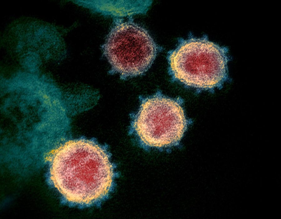 2 Novel Coronavirus SARS-CoV-2.jpg