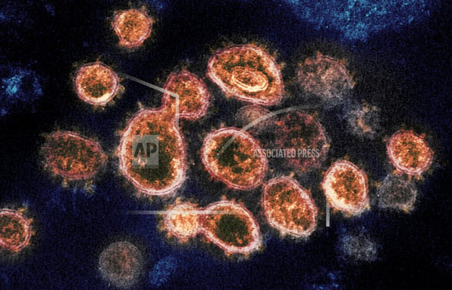 FILE - This 2020 electron microscope image provided by the National Institute of Allergy and Infectious Diseases - Rocky Mountain Laboratories shows SARS-CoV-2 virus particles which cause COVID-19, isolated from a patient in the U.S., emerging from the surface of cells cultured in a lab. Viruses are constantly mutating, with coronavirus variants circulating around the globe. (NIAID-RML via AP)